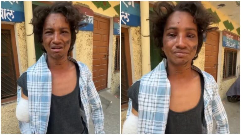 टिहरी में दिल झकझोर कर रख देने वाली घटना, भाई व भाभी ने मिलकर काट दिए छोटे भाई के दोनों हाथ, पुलिस ने किया मुकदमा दर्ज