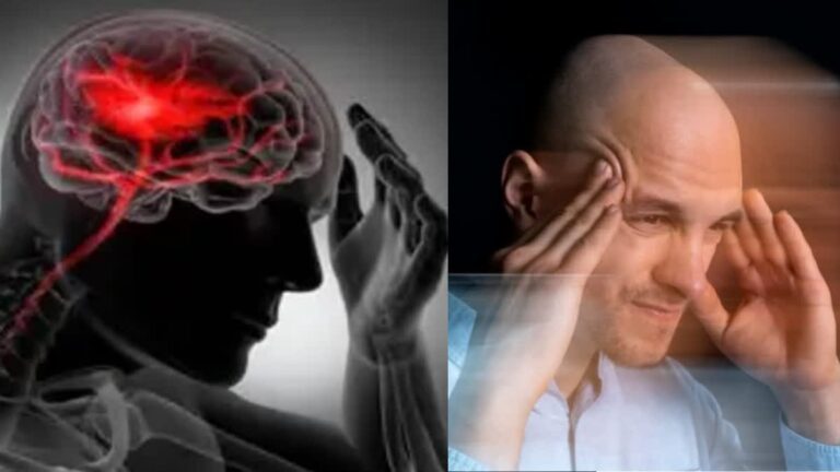 इन चार कारणों से होता है ब्रेन स्ट्रोक, इसे नजरअंदाज करना हो सकता है जानलेवा