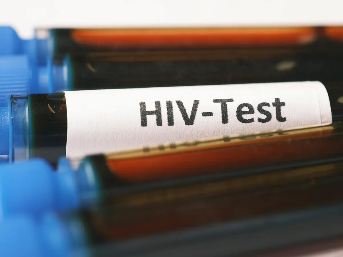 HIV_AIDS_1724912022085_1780887080808_5dfd06bd-10ff-4834-a915-3d47839b89cf